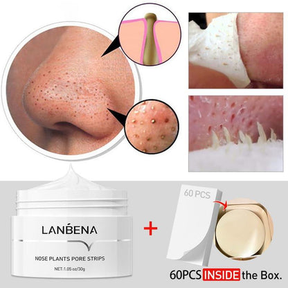 LANBENA Blackhead & Whitehead Removal Kit: Uncover Clear, Radiant Skin With The Power Of Facial Exfoliation! Experience Deeply Cleansed Acne-Free Skin 30g + 60 Sheets Gel Skincare Comfort