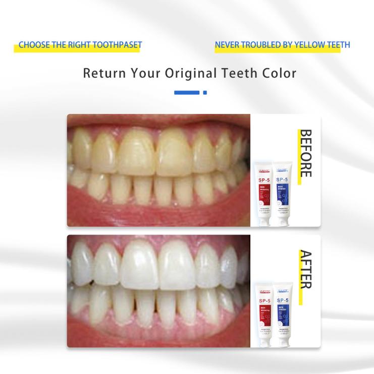 WE2C sp5 Whitening Toothpaste Teeth Cleaning Toothpaste Remove Plaque Remove Stains Oral Ordor Cleaning Bright Teeth Fresh Breath, Jasmine, Mint Gum Protection Foam Foaming SP5 Cleansing Gentle Probiotic