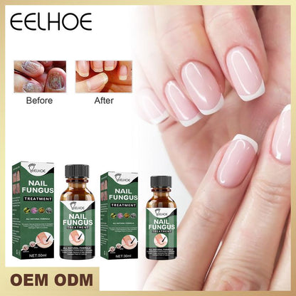 EELHOE tea tree oil for nails support Nail Care Manicure Antibacterial Daily Organic Tea Tree Nail Nutrition Fragrance Free removal anti-bacterial Remedy Comfort