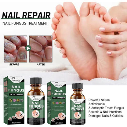 EELHOE tea tree oil for nails support Nail Care Manicure Antibacterial Daily Organic Tea Tree Nail Nutrition Fragrance Free removal anti-bacterial Remedy Comfort