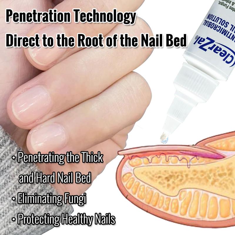 ClearZal Antimicrobial BAC Nail Solution Fungal Nail Treatment 1 Ounce Kills Fungus, Bacteria and Viruses Nail Care