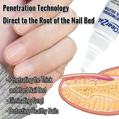 ClearZal Antimicrobial BAC Nail Solution Fungal Nail Treatment 1 Ounce Kills Fungus, Bacteria and Viruses Nail Care