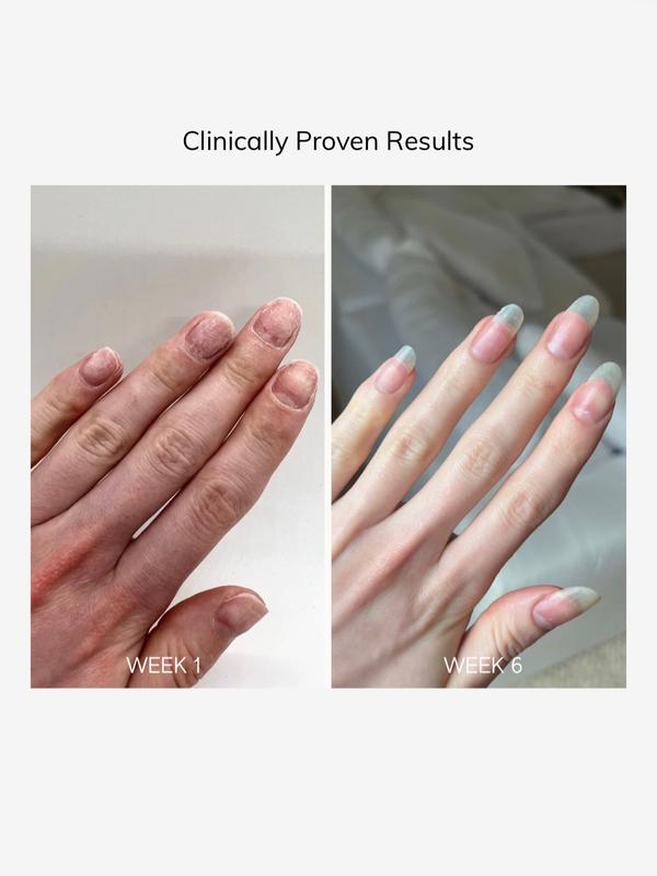 Peptide Nail Growth Oil - Nail Treatment