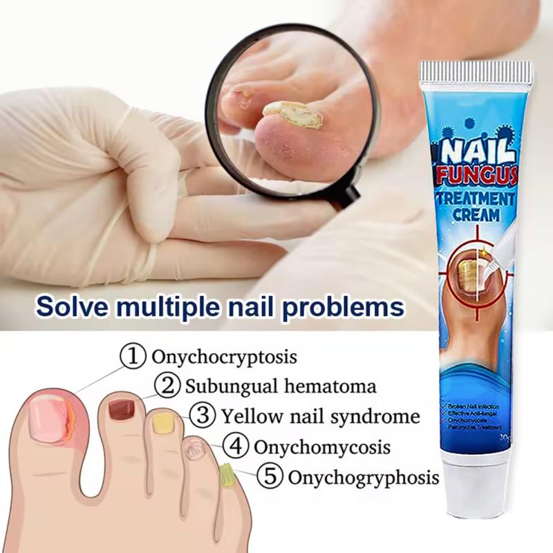 [Healthy Nail]Essential Oil Repair Gel£¬Nail Repair Treatment Cream,Nail Essence Oil,A Quick Fix for Thickened, Yellowed and Brittle Nails, Treat Nail Fungus, Treat Yellow Nail Syndrome, Treat Rotten Nails, Treat Damaged Nails, Exfoliate Nail