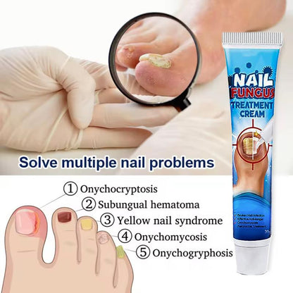 [Healthy Nail]Essential Oil Repair Gel£¬Nail Repair Treatment Cream,Nail Essence Oil,A Quick Fix for Thickened, Yellowed and Brittle Nails, Treat Nail Fungus, Treat Yellow Nail Syndrome, Treat Rotten Nails, Treat Damaged Nails, Exfoliate Nail