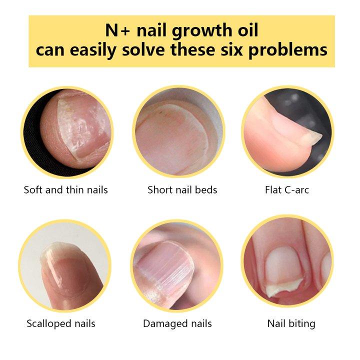 N+ Nail Growth Oil - Moisturizing, Growth, Strengthening, and Brightening Formula with Vitamins and Fatty Acids for Overall Nail Health Moisture Nail Care,Nail Growth Oil For Strength and Moisture,2ML Lemon Fragrance