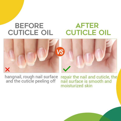 MODELONES Nail & Cuticle Care Strengthener Oil Vitamin E + B Fragrance-Free Cuticle Revitalizing Oil 15ml