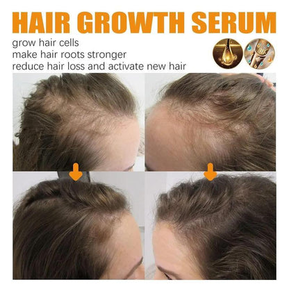 x Ginger Hair Growth Serum | Promotes Hair Growth | Prevents Hair Loss | Haircare Comfort | Strengthens Hair Roots | Soothes Scalp Itching | Nourishes Dry Hair | Hair Growth Essence | Unisex | Hair care oil | hair treatments/scalp treatments | non-toxic