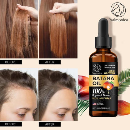 Batana Oil for Hair Growth: Raw Batana Oil Dr Sebi Organic from Honduras - Veganic Natural Hair Growth Oil for Damaged Hair - Split Ends Hair Treatments for Women - 60ml (Brown)