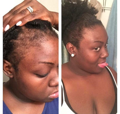 Anti Breakage Hair Growth Shea Butter Haircare Moisture Coconut Olive Oil and Castor Oil