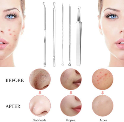 8 Pcs Blackhead Remover Whitehead Blemish Removal Tool Pimple Popper Tool Kit