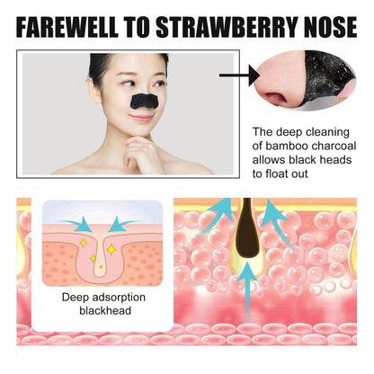 Deep Cleansing Nose Blackhead Pads (10pcs/box*2 Boxes), Facial Pore Cleaner, Blackhead Cleaning Patches, Nose Pore Strips