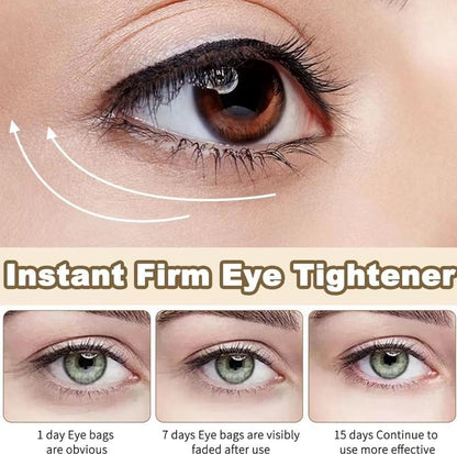 Instant Eye Tightener,Anti-Aging Eye Cream,Eye Bag Cream,Firming Eye Cream, Firm Eye Cream for Dark Circles and Reduce Puffiness,Instant Eye Lift Serum,Wrinkle Remover