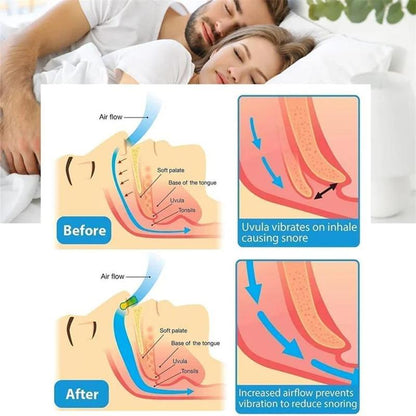 Silicone?Snoring Nose Clips, 6pcs/set Portable Anti Snoring Devices, For All Nose Shapes