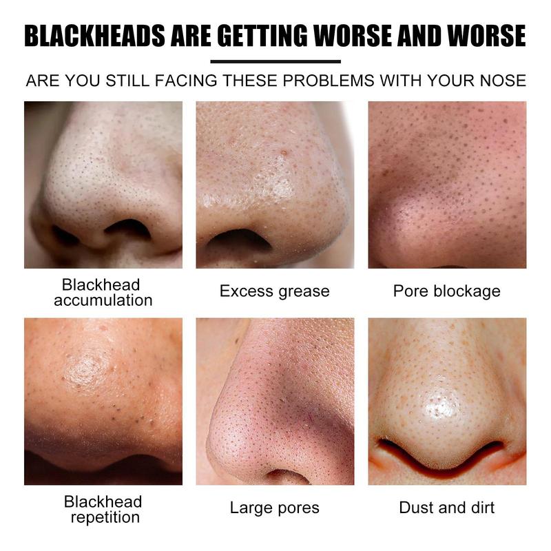 Deep Cleansing Nose Blackhead Pads (10pcs/box*2 Boxes), Facial Pore Cleaner, Blackhead Cleaning Patches, Nose Pore Strips