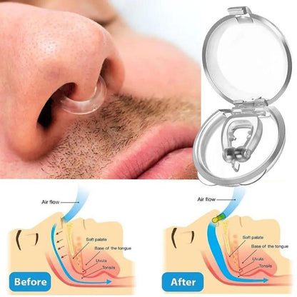 Silicone?Snoring Nose Clips, 6pcs/set Portable Anti Snoring Devices, For All Nose Shapes