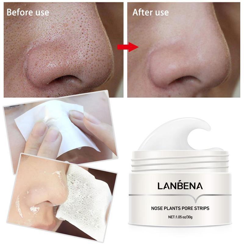 LANBENA Blackheads & Whiteheads Removal Kit for Clear, Radiant Skin_ Facial Exfoliating Power, Acne Deep Cleansing, 30g Clay Mask, and Nasal Strips for a Fresh