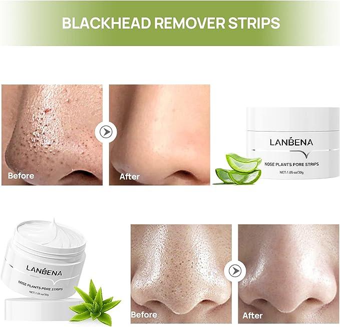 Best Seller Lanbena Blackhead Whiteheads Remover Mask Facial Peeling Nose Strip Acne Deep Cleansing 30g