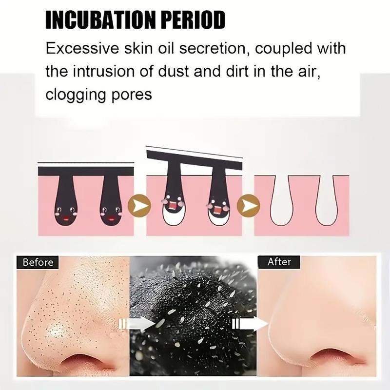 10pcs Blackhead Remover Nose Strips, Deep Cleansing Nasal Pores Stickers, Nose Mask Blackhead Pore Strips Blackhead Remover for Nose Face Chin and Forehead